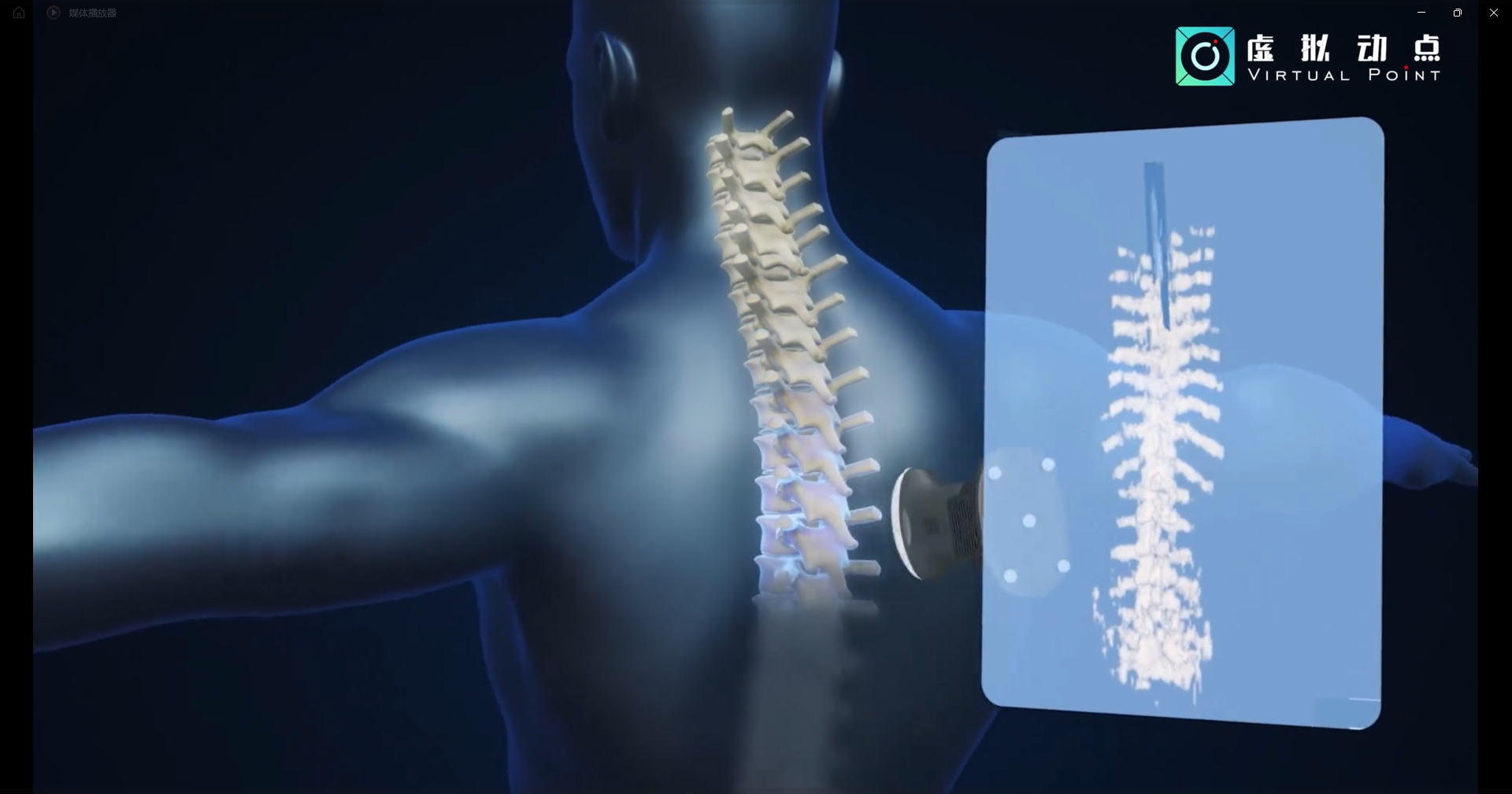 bg大游·虚拟动点OptiTrack开创3D超声成像在脊柱诊断中的应用